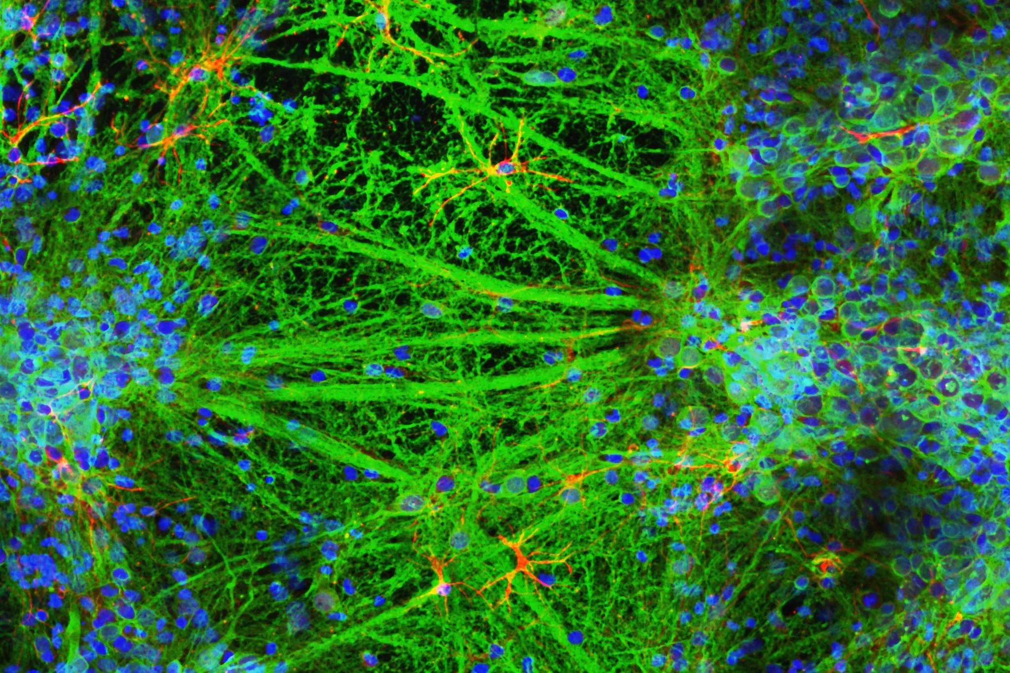 Neural network research visualization - 3D printed brain cells